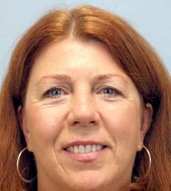 After Results for Mole Removal