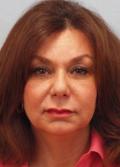 After Results for Blepharoplasty, Laser Skin Resurfacing, Fat Transfer